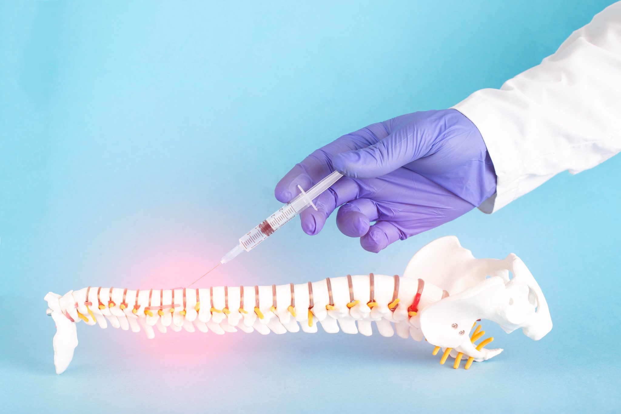 End Your Pain. Restore Your Youth: Regenerative Stem Cell Therapy at Keller Disc & Spine